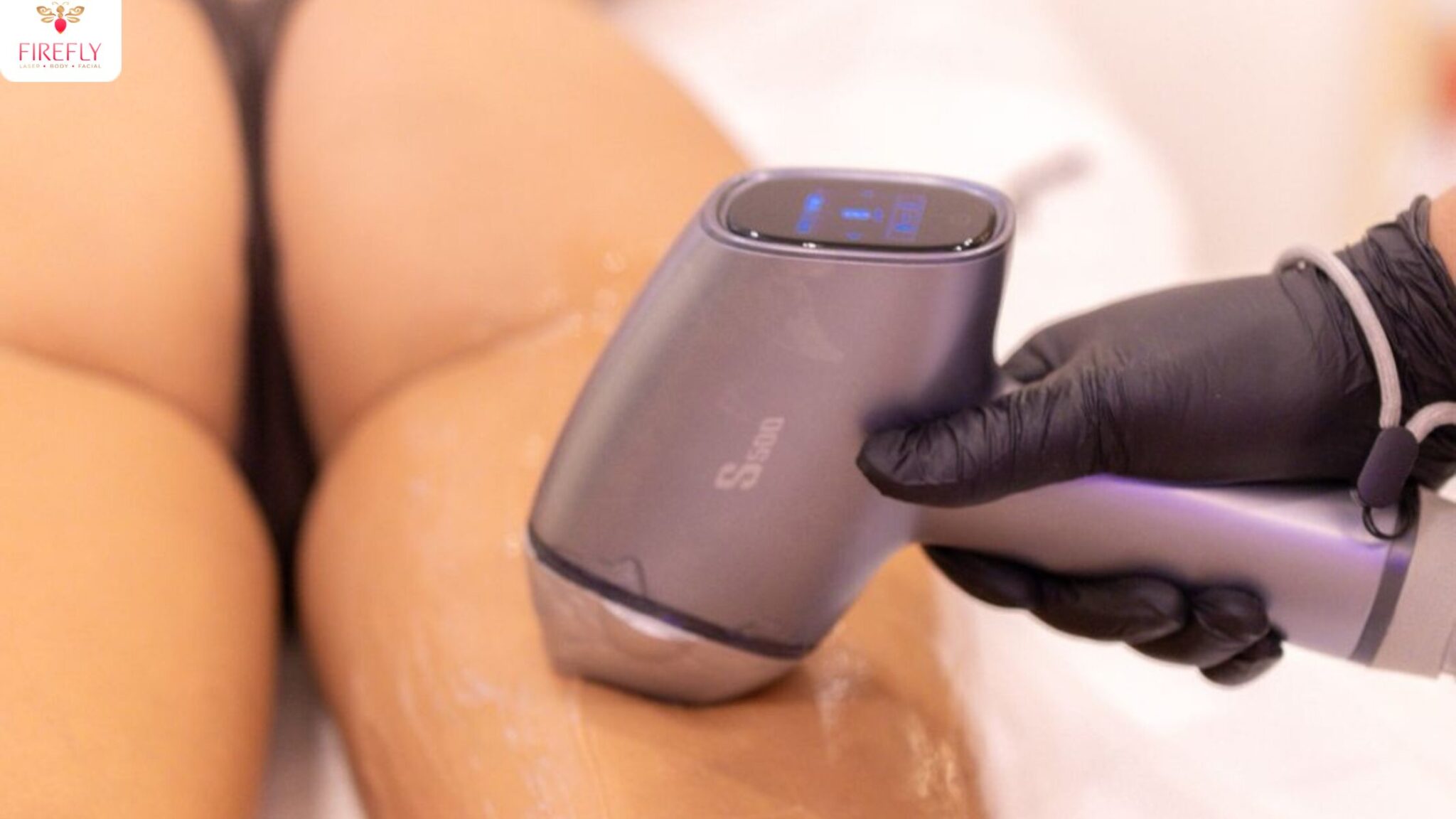 Close up of diode laser treatment during laser hair removal at Firefly Bali