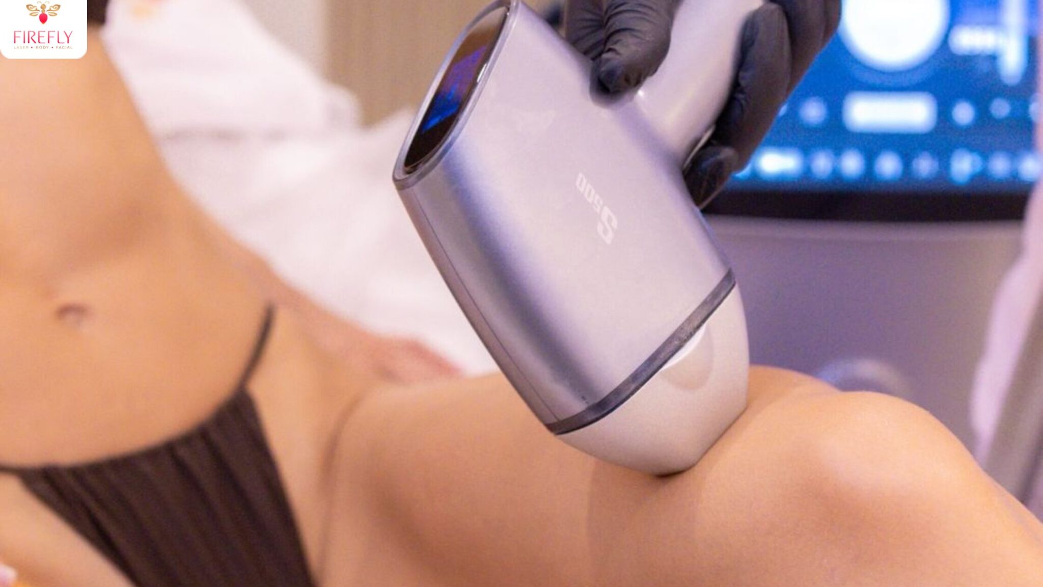 Firefly therapist performing full legs laser hair removal treatment in Bali