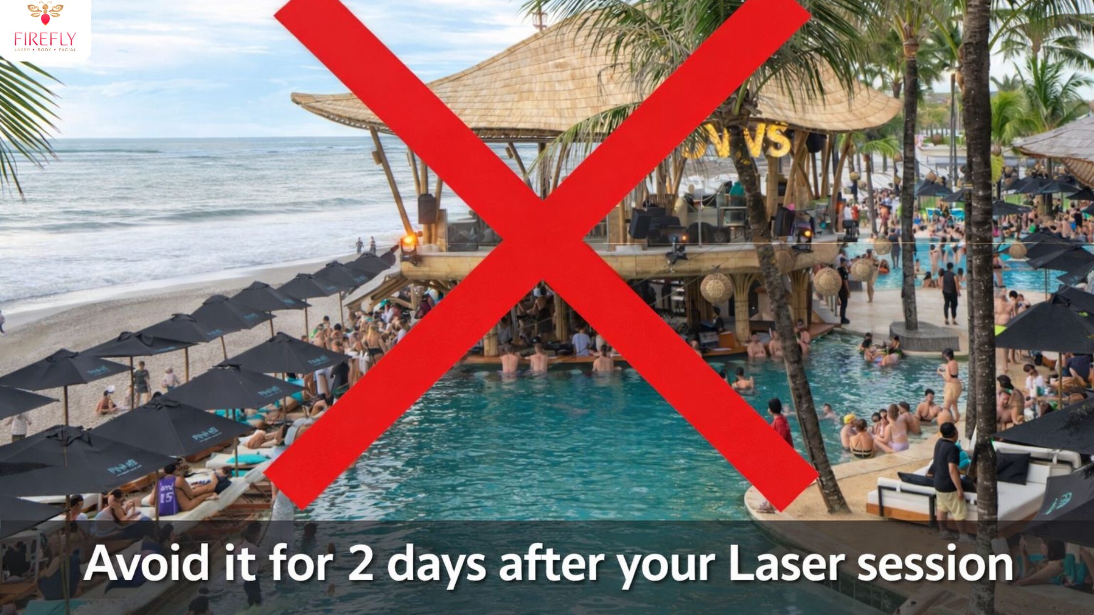 Sun exposure and swimming pool should be avoided for 48 hours after laser hair removal treatment