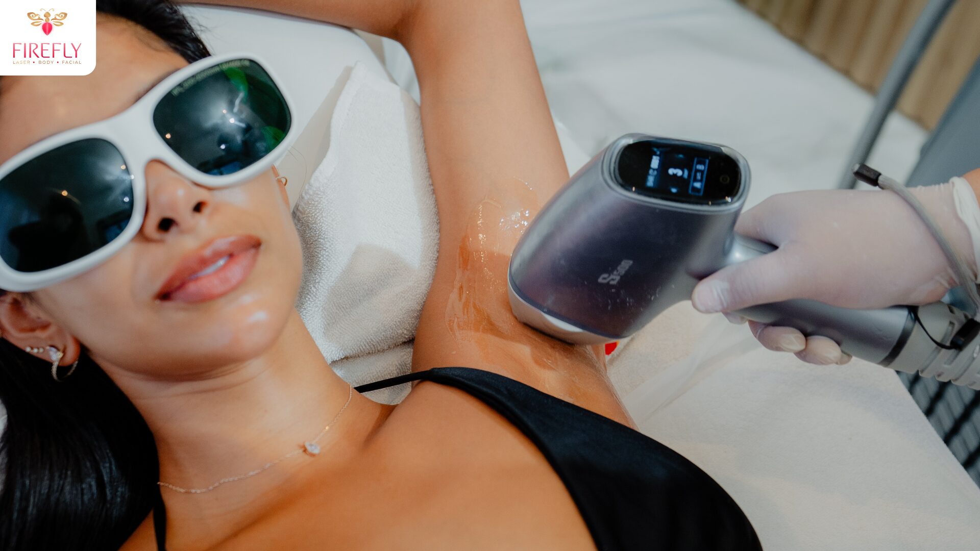 Firefly Laser Bali underarm laser hair removal treatment for smoother skin and reduced hair growth in Canggu