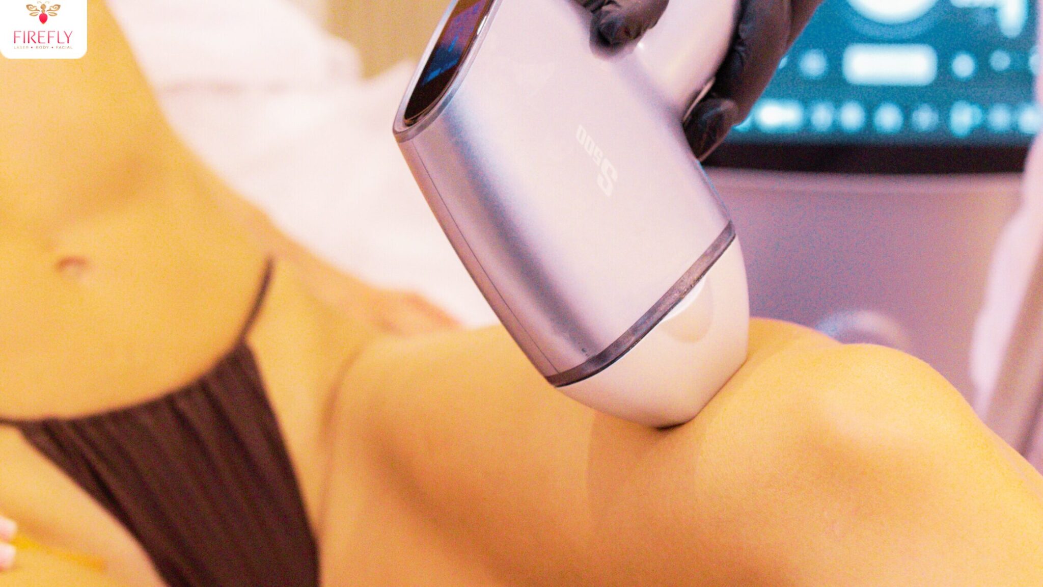 Diode laser used for full legs laser hair removal at Firefly Bali