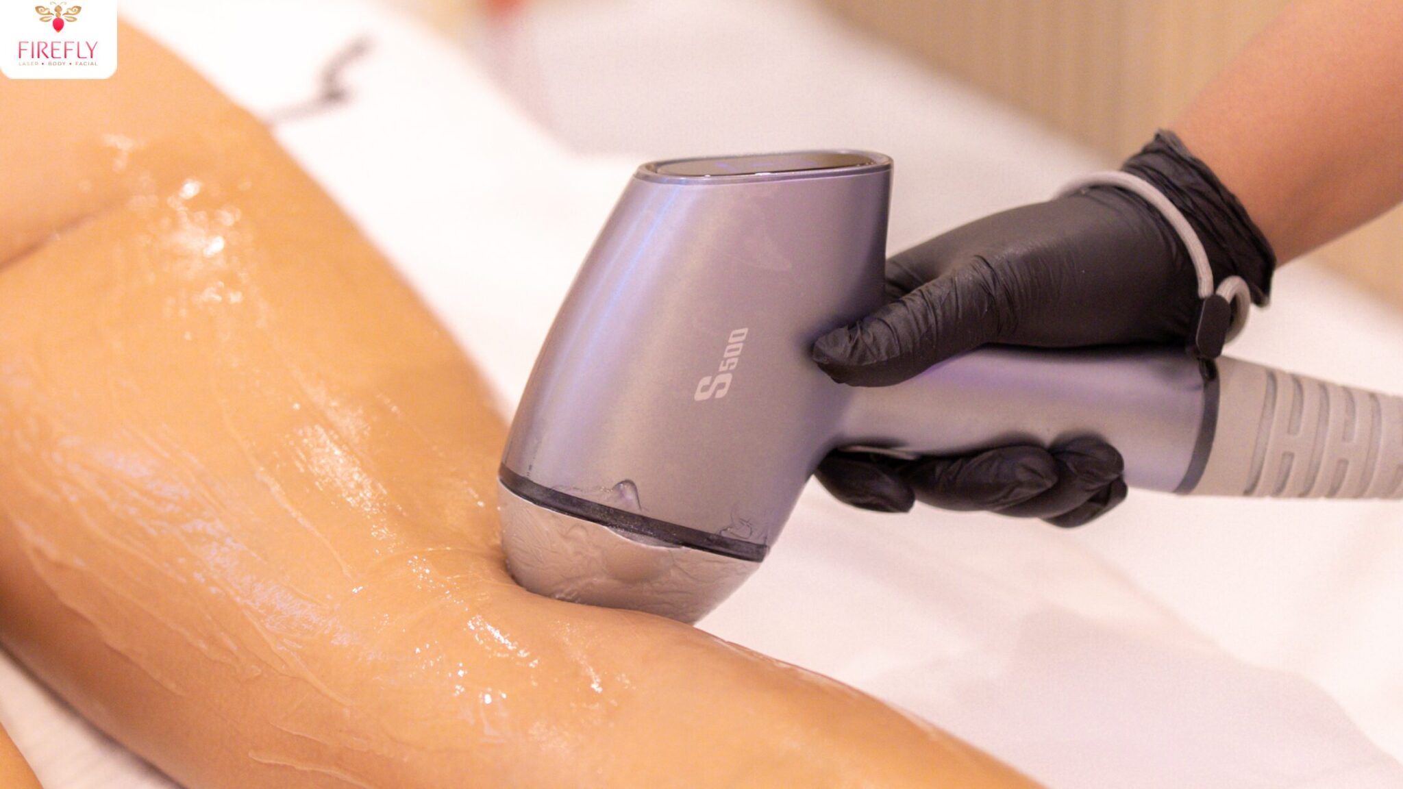 Smooth legs after full legs laser hair removal treatment at Firefly Canggu